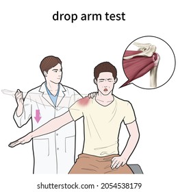 3d Medical Illustration Explain Drop Arm Stock Illustration 2054538179 ...