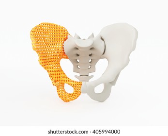 3d Printed Hip Bone