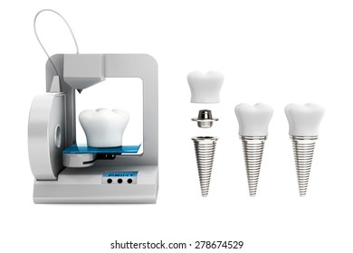 3d Printer Printing Tooth Implant On A White Background