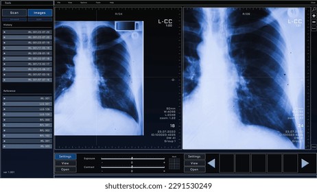 3D Render: Computed Tomography Chest Scan Mock-up with Multiple Windows and Data. Medical Research Environment Software with CT Scan Results for Computer Displays and Laptop Screens.