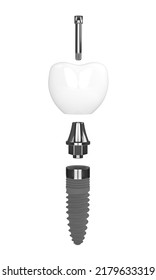 3d Render Of Dental Implant Over White Background