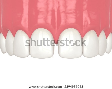 3d render of diastema closure using bonding procedure. Part 1. Diastema. Closing diastema procedure concept.