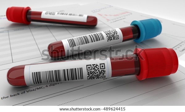 3dレンダーイラスト血液検査用チューブと分析依頼書 のイラスト素材