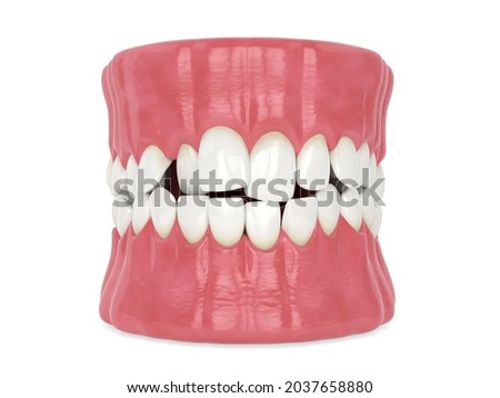 3d render of jaw with abnormal toothing isolated over white background