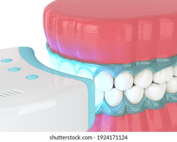  3D Kieferrenderung mit Zahnbleichen durch Uv-Lampe. Zähne-Weißkonzept. 