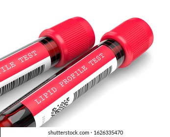3d render with lipid profile test blood samples over white background