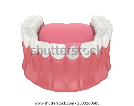 3d render of lower jaw with post and core tooth restoration over white background