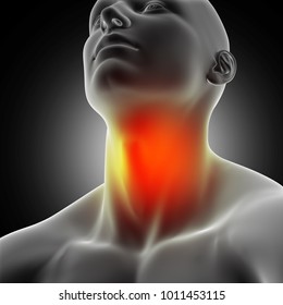 3D Render Of A Male Medical Figure With Sore Throat