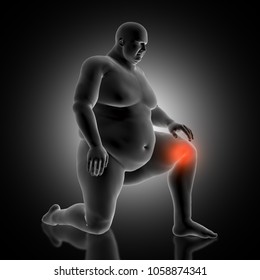3D Render Of A Medical Background With Overweight Male Figure Holding His Knee In Pain