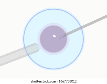 3d Render Medical Illustration Artificial Insemination Stock ...