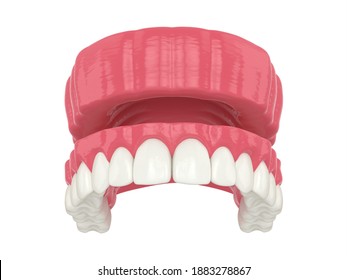 Overdenture Images, Stock Photos & Vectors | Shutterstock