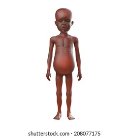 3d Render Of A Starving African Child