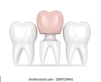 3d Render Of Teeth With Dental Crown Restoration Over White Background