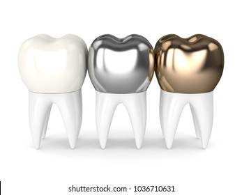 3d Render Of Teeth With Gold, Amalgam And Composite Dental Crown Over White Background