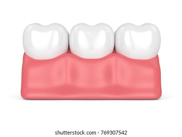 3d Render Of Teeth In Gums Over White Background