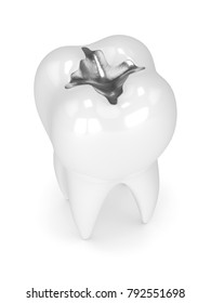 3d Render Of Tooth With Dental Amalgam Filling Over White Background