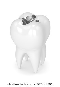 3d Render Of Tooth With Dental Amalgam Filling Over White Background