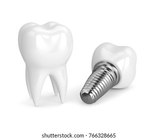 3d render of tooth with dental implant isolated over white background