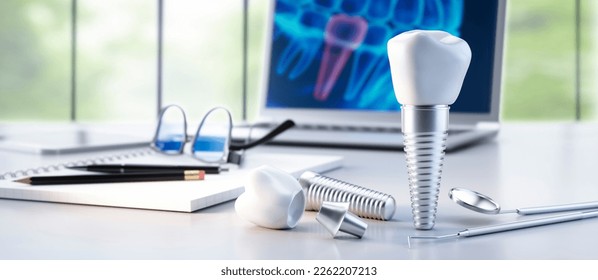 3D render of tooth implant on a  dentist´´ s office workplace background - 3D illustration - Powered by Shutterstock