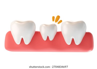 3D render of an undersized tooth showing pain or sensitivity between normal teeth. Concept for orthodontics, pediatric, and small tooth issues.