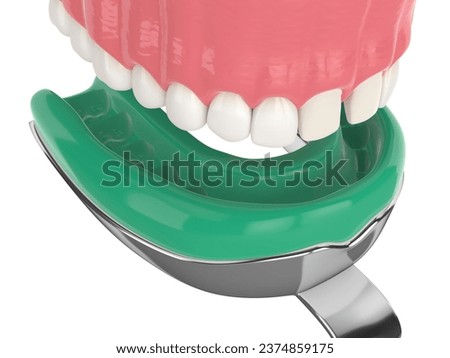 3d render of upper jaw with dental impression tray over white background