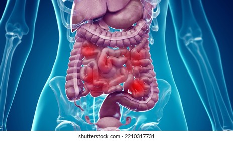 3d Rendered Illustration Of The Female Abdominal Organs