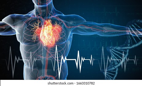 3d rendered illustration of heart attack and heart disease 3D illustration