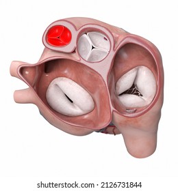 3d Rendered Illustration Of The Heart Valves - The Pulmonary Valve