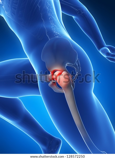 3d Rendered Illustration Hip Joint Pain Stock Illustration 128572250 ...