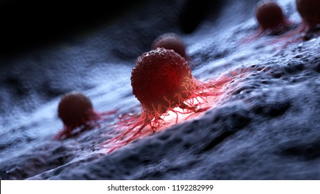 3d Rendered Illustration Of A Human Cancer Cell