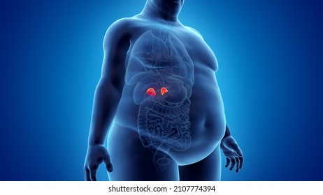 3d rendered illustration of an obese mans adrenal glands