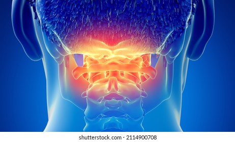 3d Rendered Illustration Of A Painful Atlas Bone