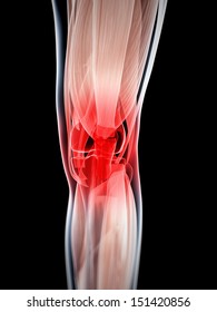 3d Rendered Illustration Painful Knee Stock Illustration 151420856