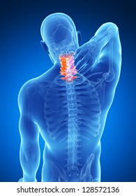 3d Rendered Illustration - Painful Neck