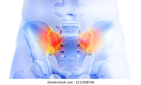 3d rendered illustration of a painful sacroiliac joint