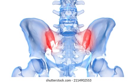3d rendered illustration of a painful sacroiliac joint
