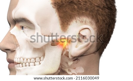 3d rendered illustration of a painful temporomandibular joint Stock photo © 