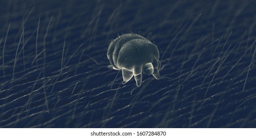 3d Rendered Illustration Of A Scabies Mite On Human Skin, Sem Style