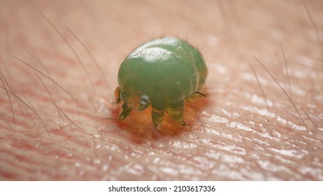 3d Rendered Illustration Of A Scabies Mite