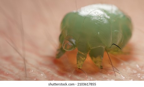 3d Rendered Illustration Of A Scabies Mite