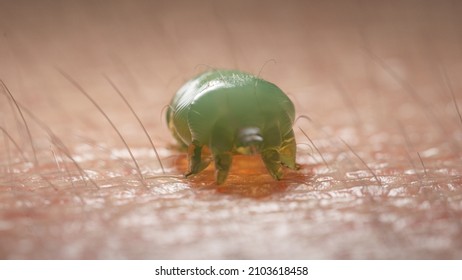 3d Rendered Illustration Of A Scabies Mite