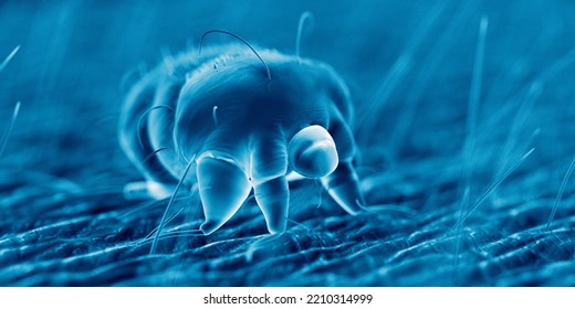 3d Rendered Illustration Of A Scabies Mite On Human Skin, Sem Style