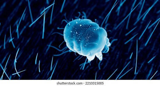 3d Rendered Illustration Of A Scabies Mite On Human Skin, Sem Style