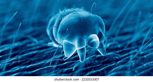 3d Rendered Illustration Of A Scabies Mite On Human Skin, Sem Style