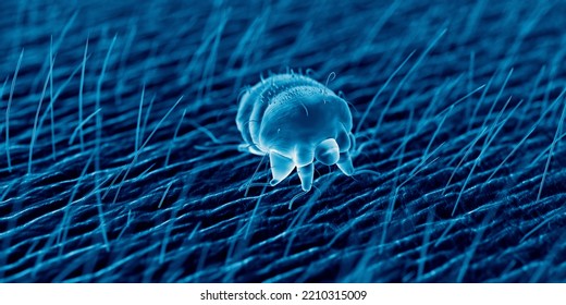 3d Rendered Illustration Of A Scabies Mite On Human Skin, Sem Style