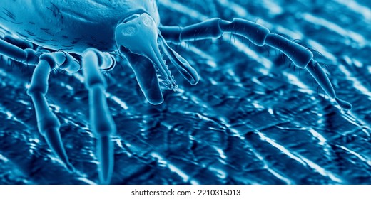 3d Rendered Illustration Of A Tick On Human Skin, Sem Style