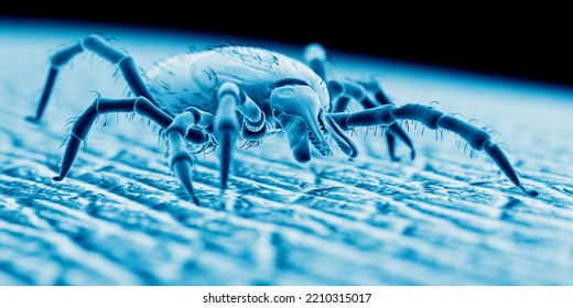 3d Rendered Illustration Of A Tick On Human Skin, Sem Style