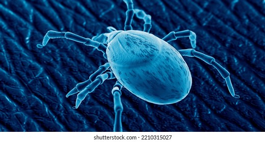 3d Rendered Illustration Of A Tick On Human Skin, Sem Style