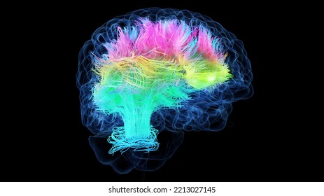 3d Rendered Medical Illustration Of Colored White Brain Matter Fibres