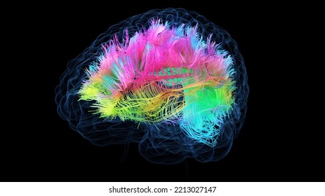 3d Rendered Medical Illustration Of Colored White Brain Matter Fibres